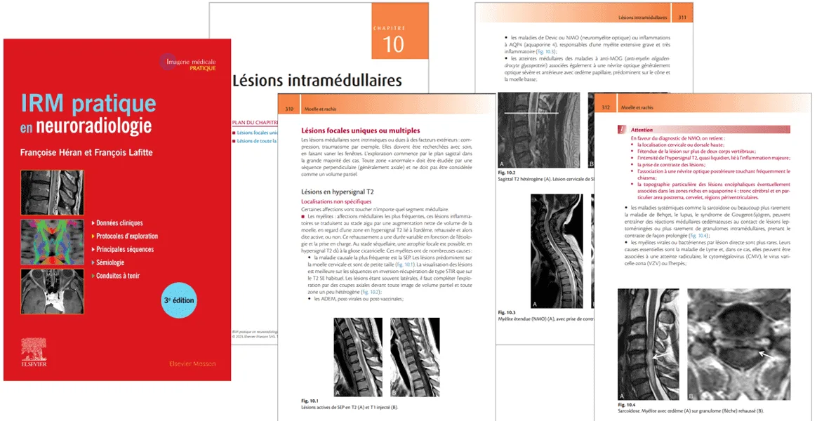 IRM pratique en neuroradiologie : 3e édition 2023