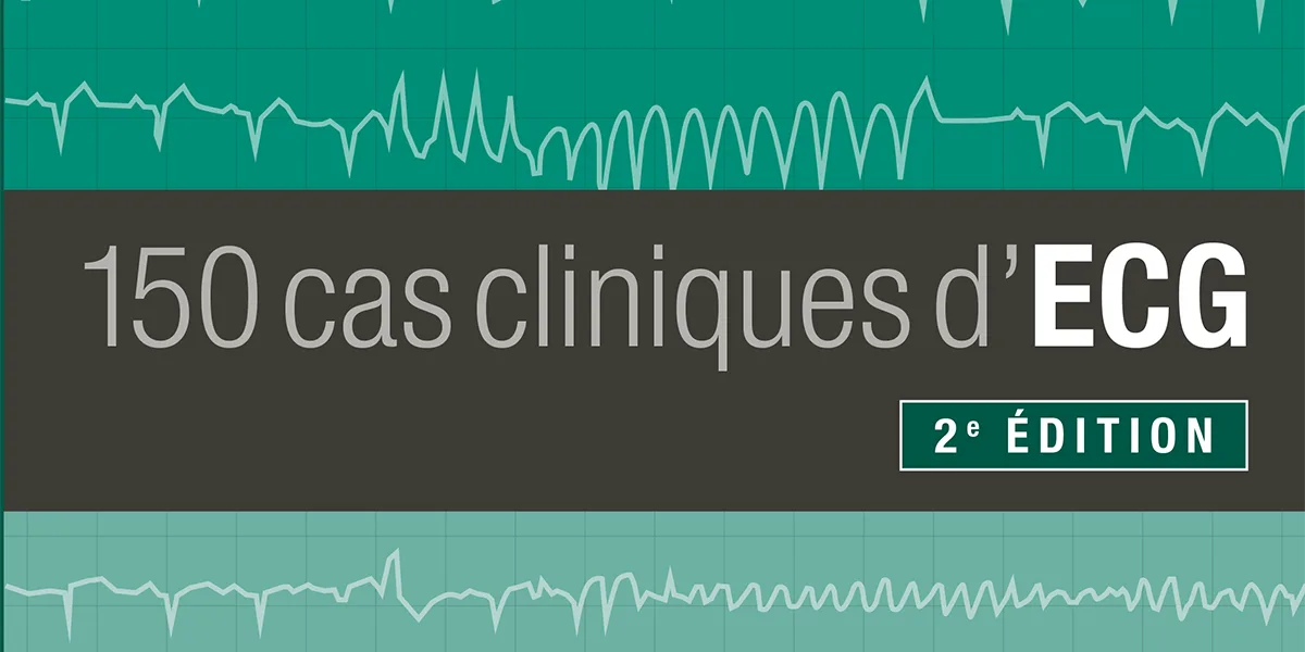 150 cas cliniques d'ECG