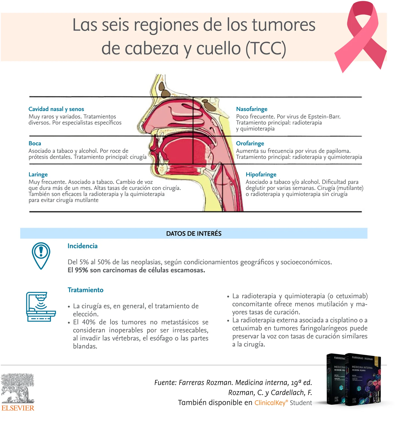 Infografia: Las seis regiones de los tumores de cabeza y cuello (TCC)