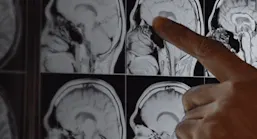 Step forward: STATdx - Dr. Richard J. Pacini, Diagnostic Radiologist, USA