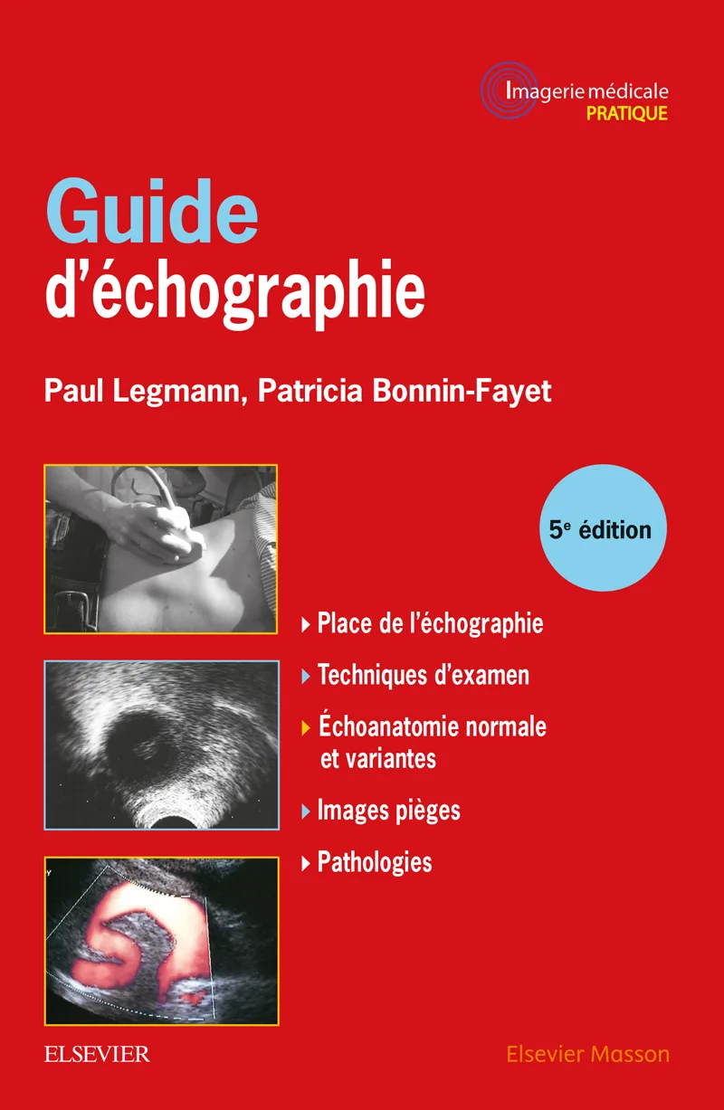 Guide d-échographie