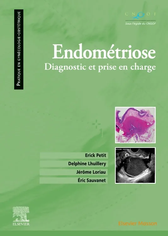 Endométriose