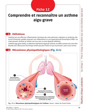 Fiche 12 Comprendre et reconnaître un asthme aigu grave