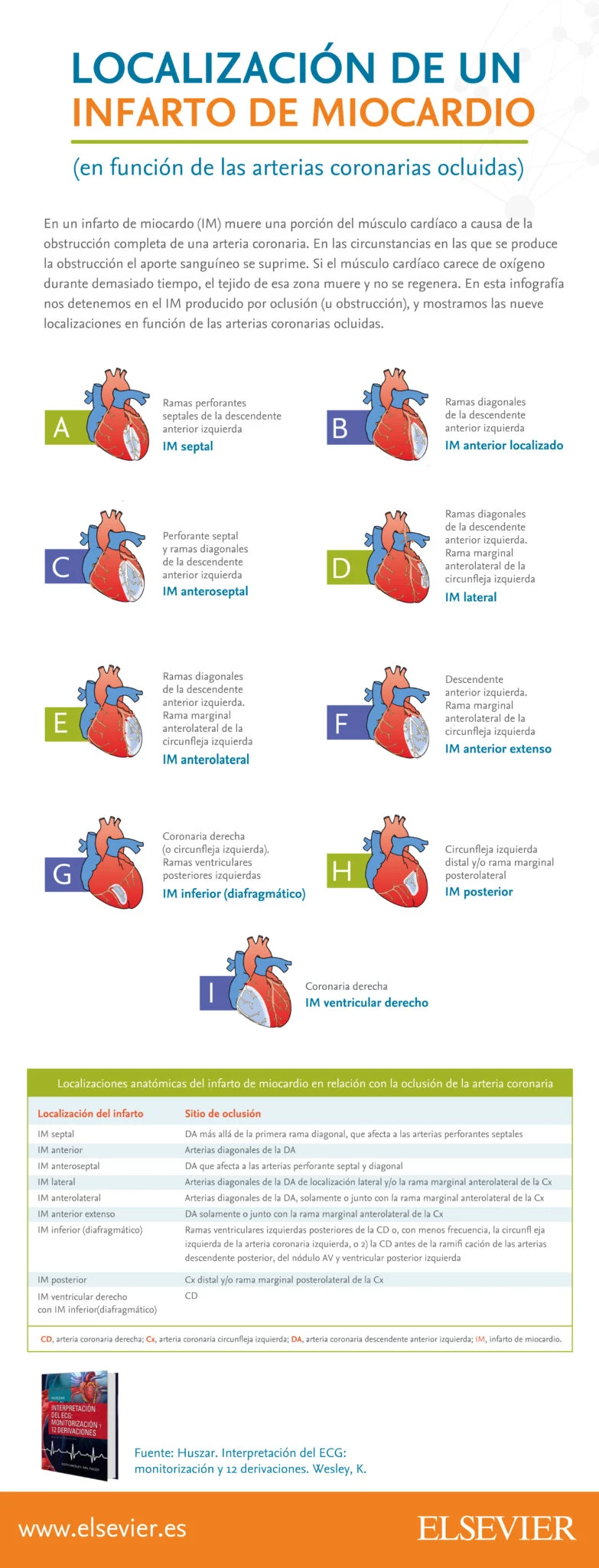 Infografia Infarto de miocardo