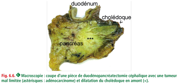 Référentiel Anatomie Et Cytologie Pathologiques édition 2023