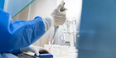 Person's arm, pipetting in lab