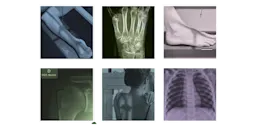 collection of xray and body parts