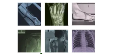 collection of xray and body parts