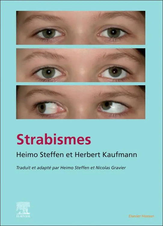 Strabismes