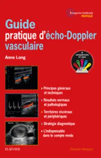 Echo-doppler vasculaire : qu'est ce que c'est ?