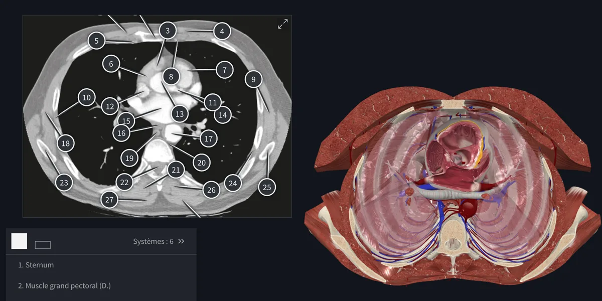 Plateforme Complete Anatomy - Radiologie