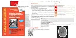 Collège médecine intensive