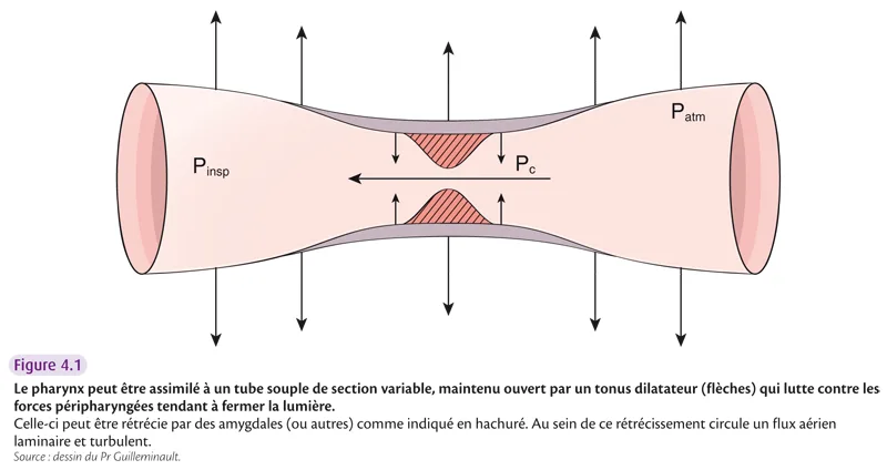 Fig 4 1