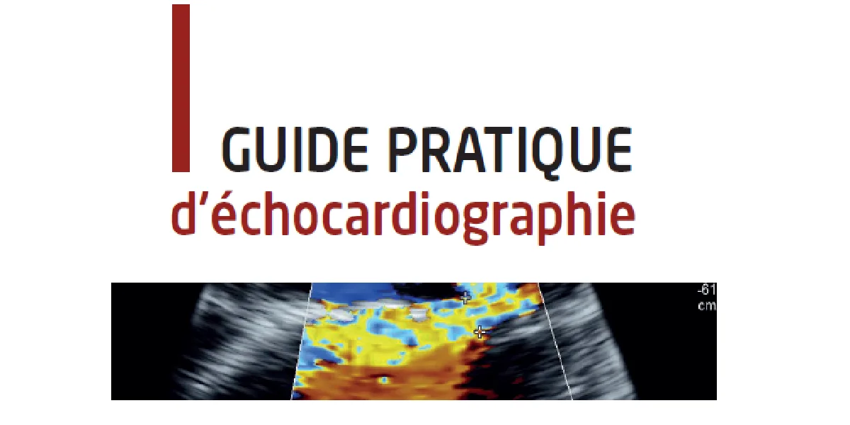 Banner - Guide pratique d-échocardiographie