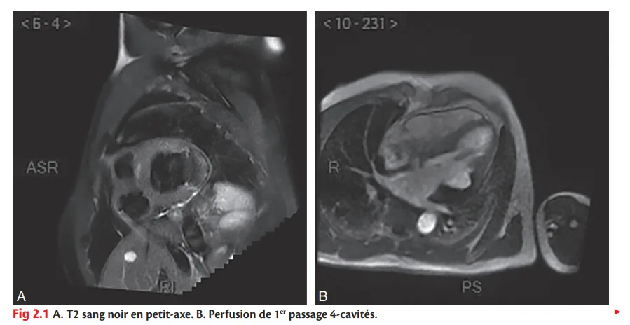Cas cliniques en imagerie cardiaque