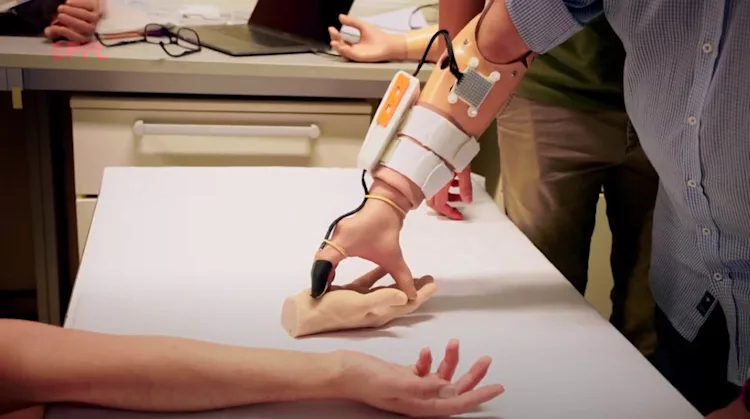 Testing The Bionic Arm Temperature-sensitive bionic hand improves dexterity and feelings of ...