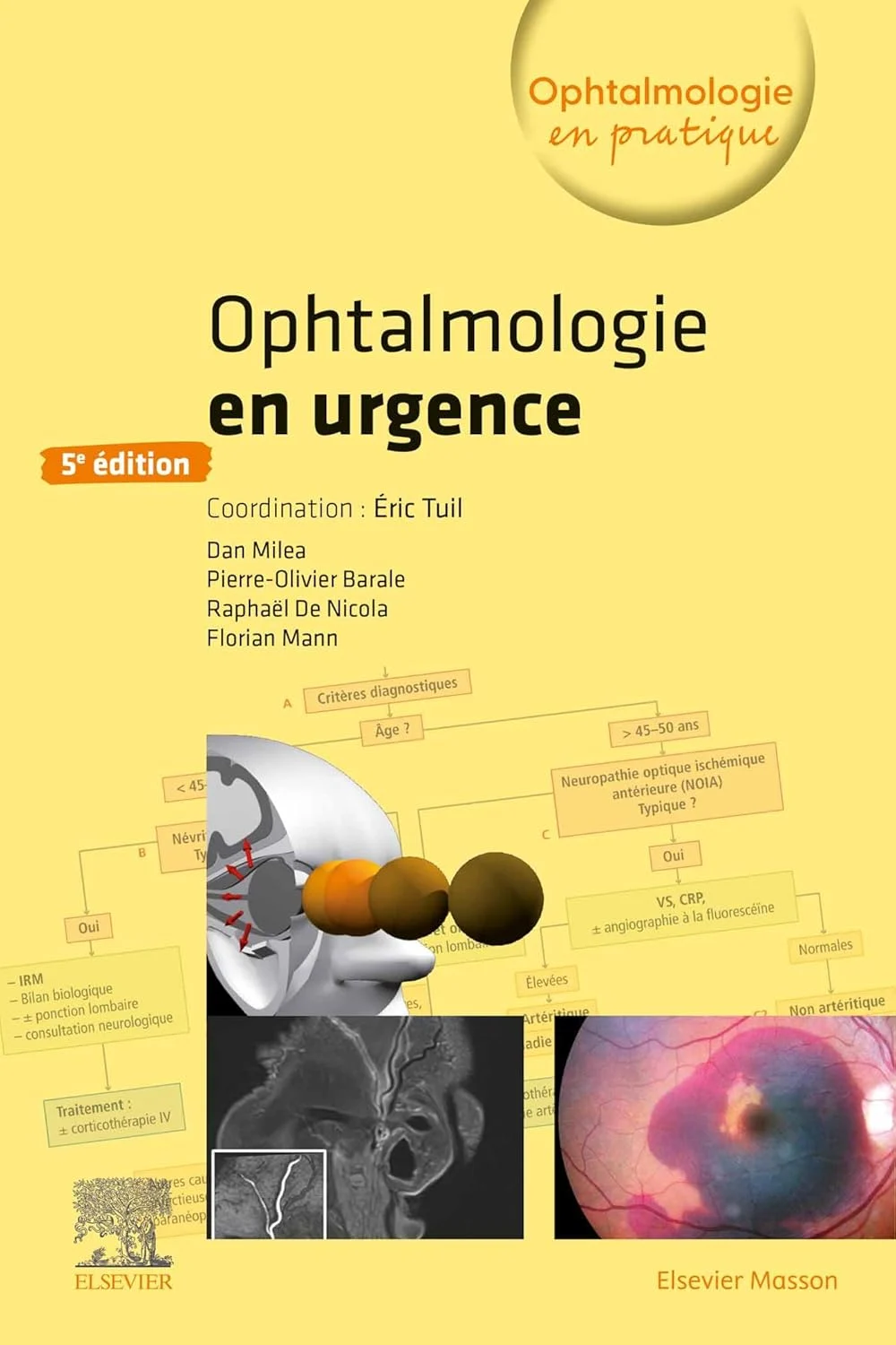 Ophtalmologie en urgence