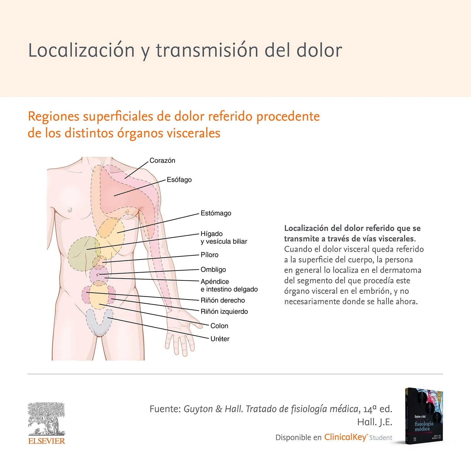 Infografia SLM Localizacion Transmision Dolor GuytonHall 2