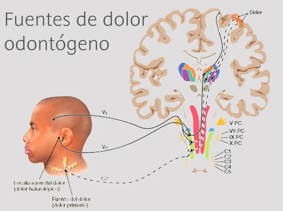 Dolor Odontogeno Principal