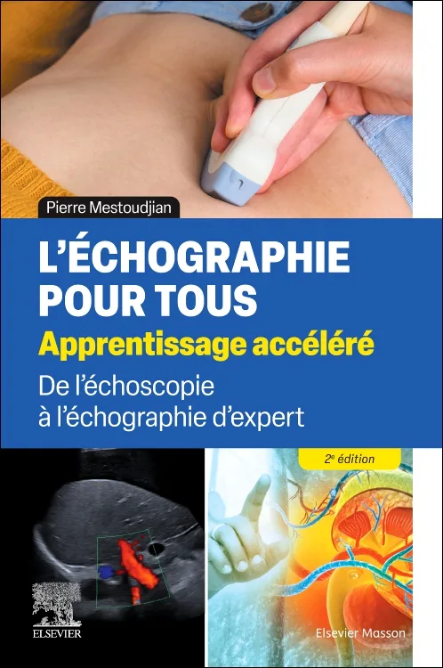 L’échographie pour tous : apprentissage accéléré