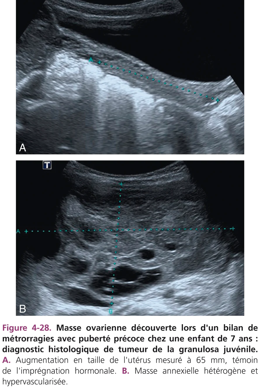 Fig 4-28