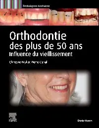 Orthodontie des plus de 50 ans