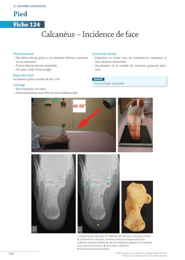 Fiche 124. Calcanéus – Incidence de face