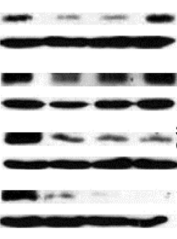 quantifications of western blots with imagej
