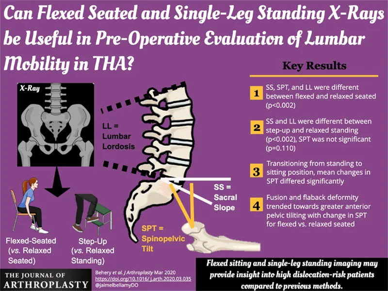 JA Graphical Abstract Spine and Hip