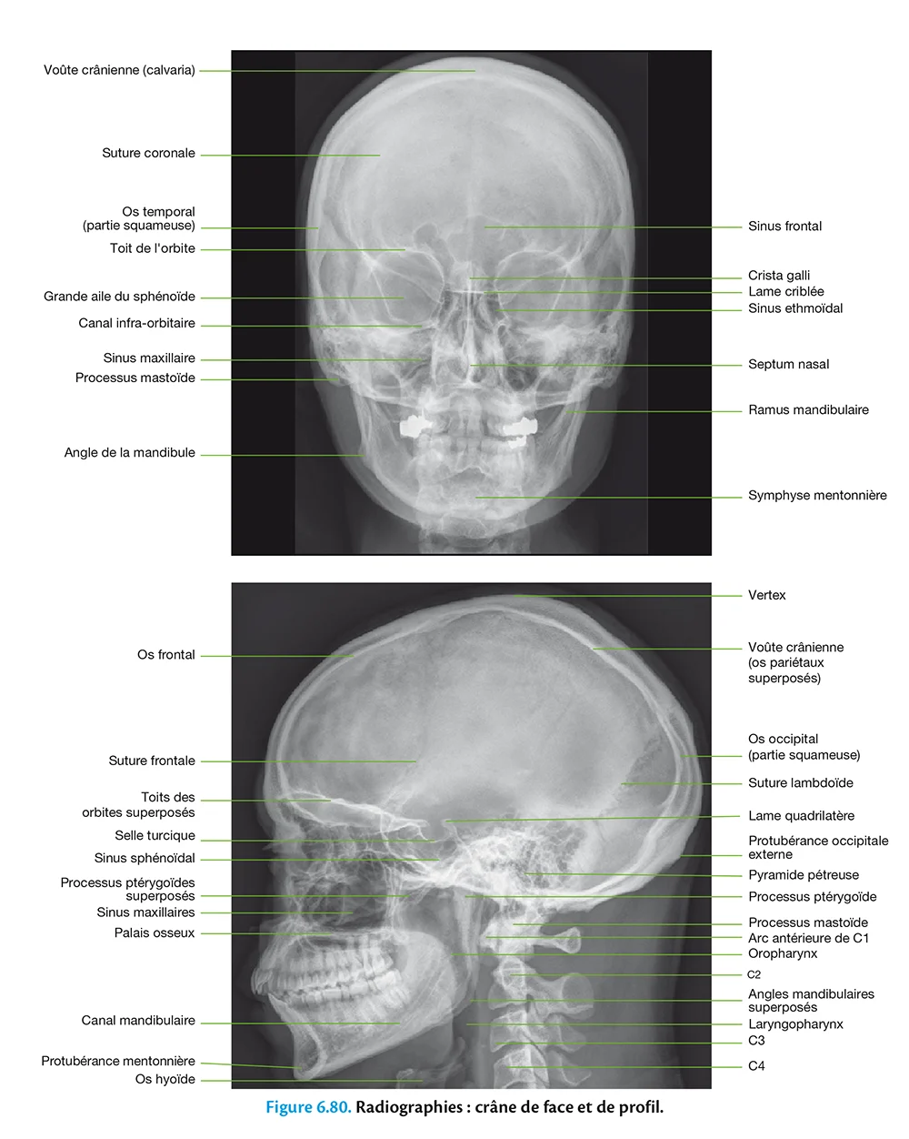 Crâne Illustrations: anatomie normale