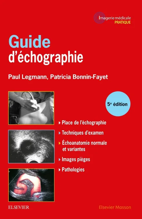 Guide pratique d'échographie