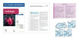 LES CAHIERS INFIRMIERS : Cardiologie