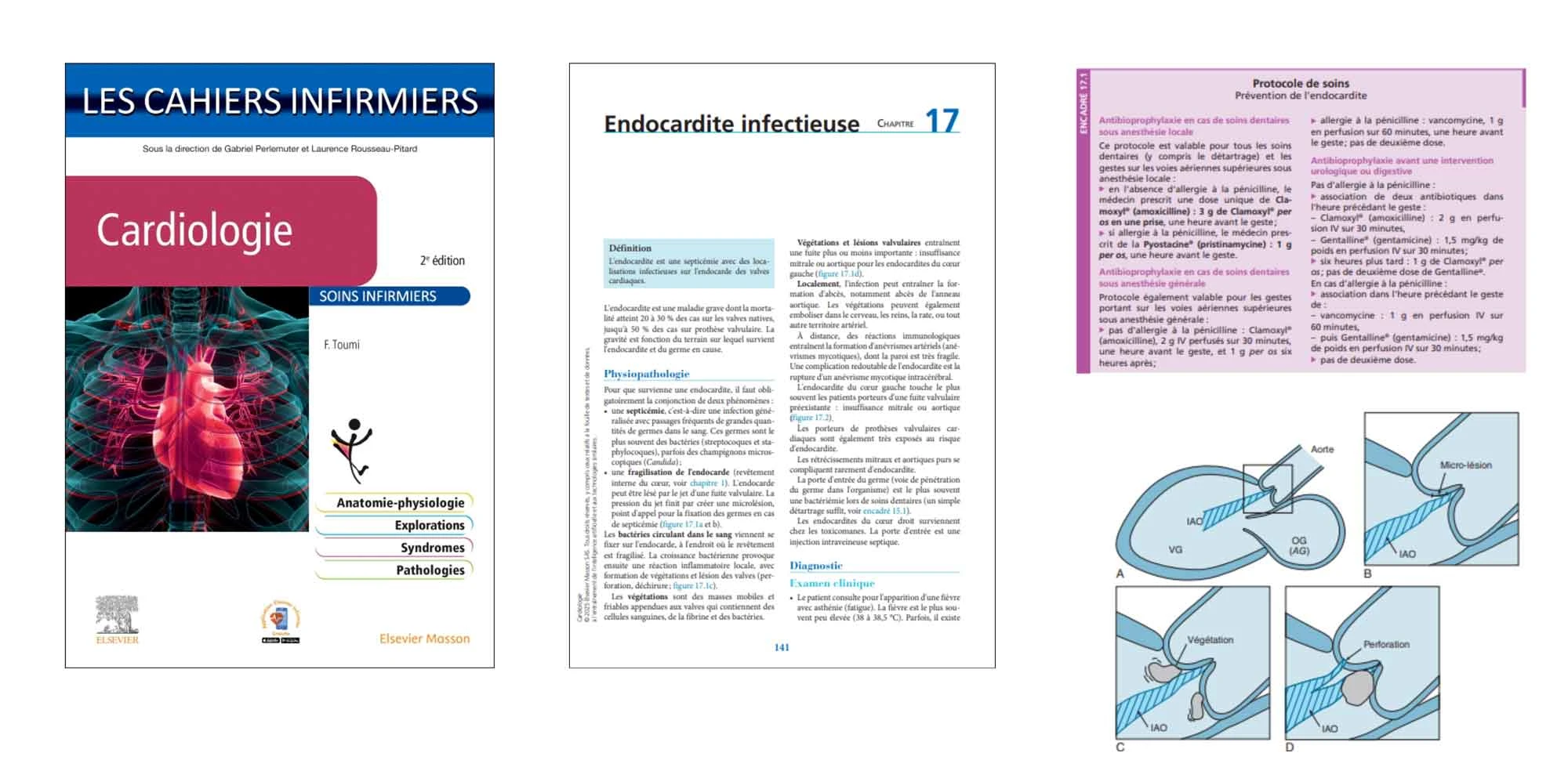 LES CAHIERS INFIRMIERS : Cardiologie