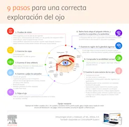 Infografia Exploracion Ojo