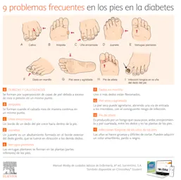 Infografia problemas frecuentes pies Diabetes