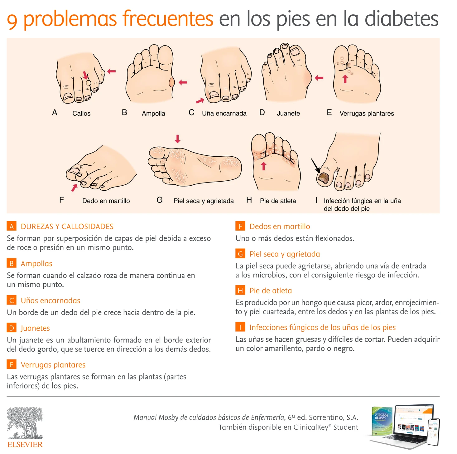 Infografia problemas frecuentes pies Diabetes