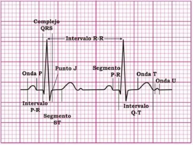 electrocardiograma basico