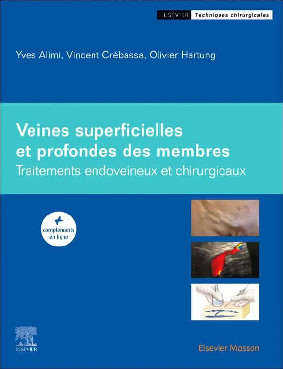 Veines superficielles et profondes des membres