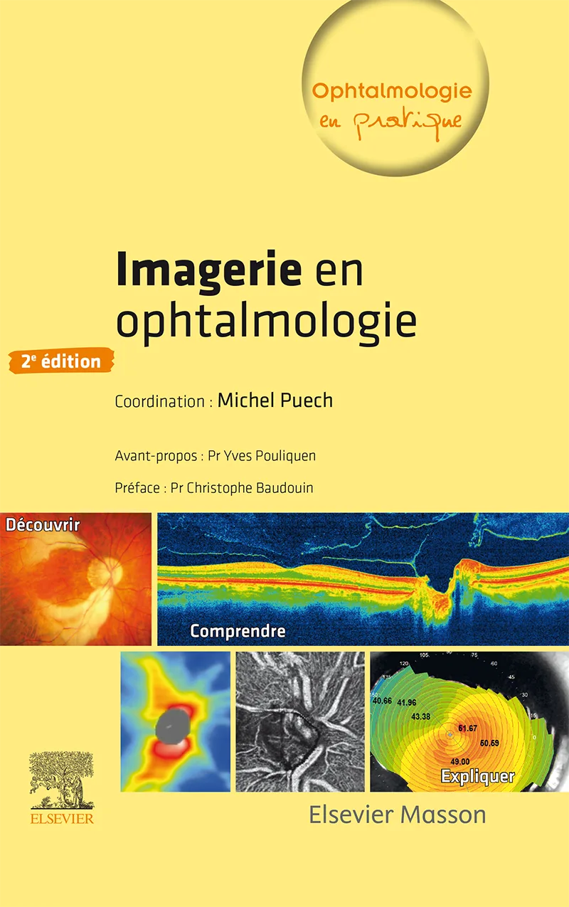 Imagerie en ophtalmologie