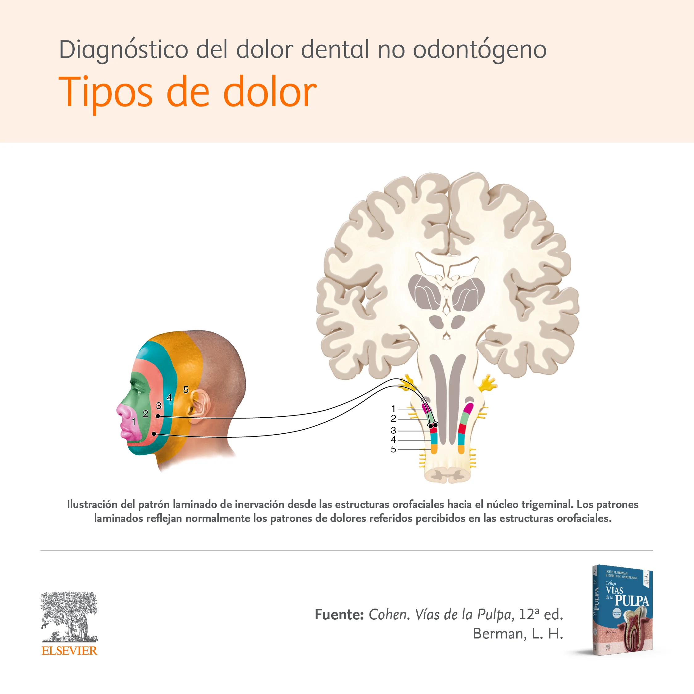 Infographic 2: Diagnósticos del dolor dental no odontógeno - Tipos de dolor
