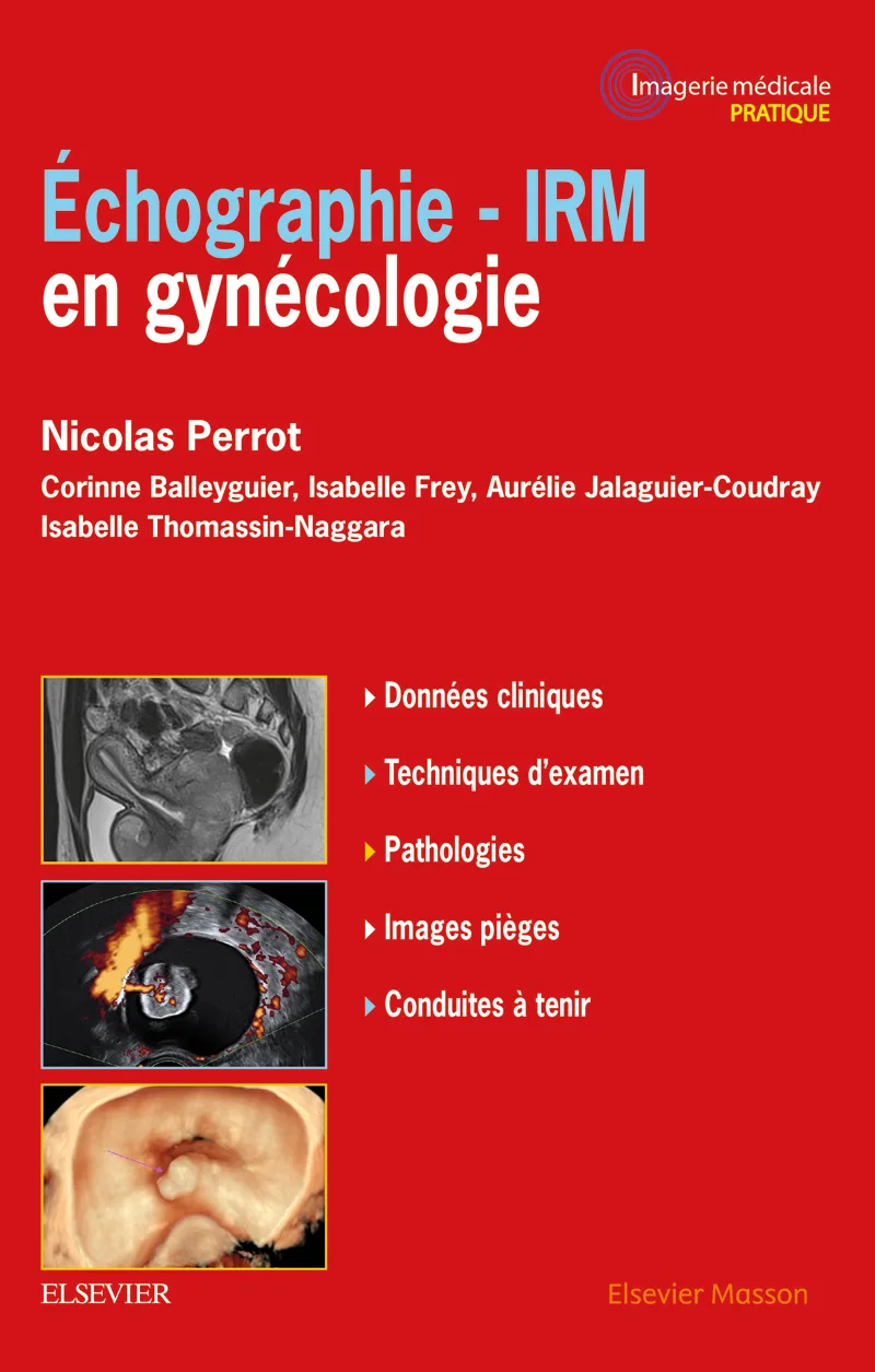 Échographie-IRM en gynécologie