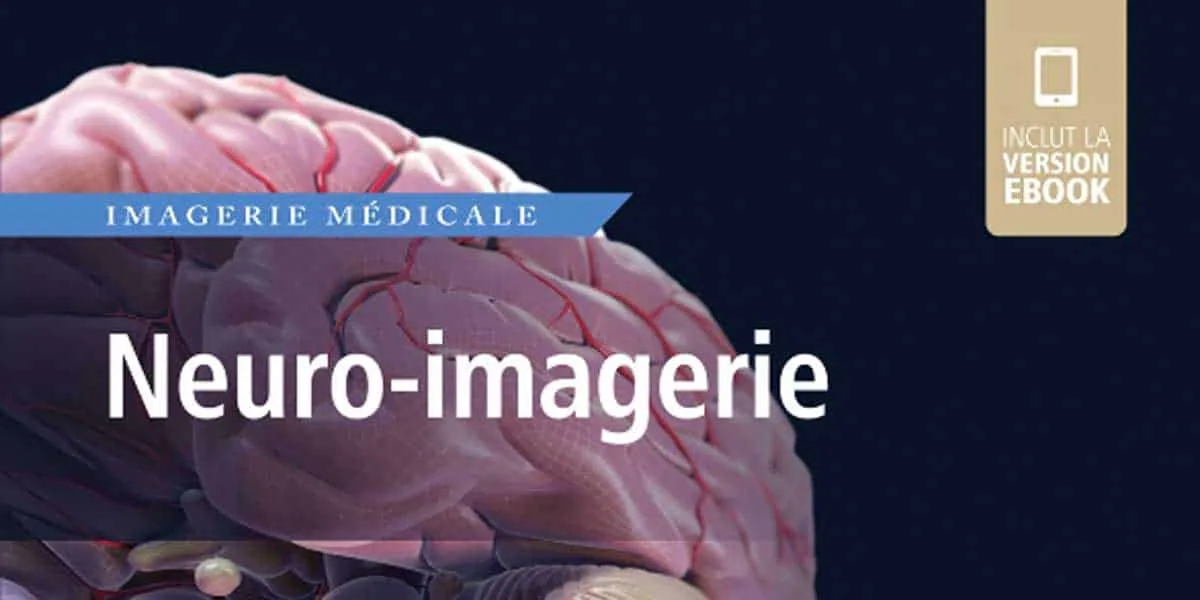 AMIRSYS : Neuro-imagerie