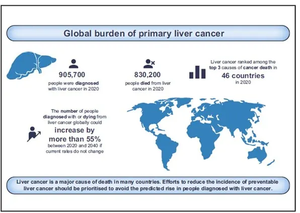 Illustration showing global burden of liver cancer