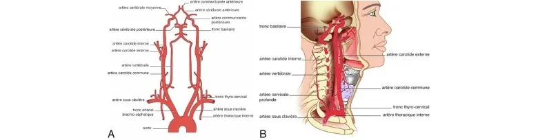 Anatomie normale. a. Artères cervico-encéphaliques. b. Rapports avec les structures cervicales.