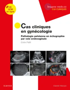 Gynécologie