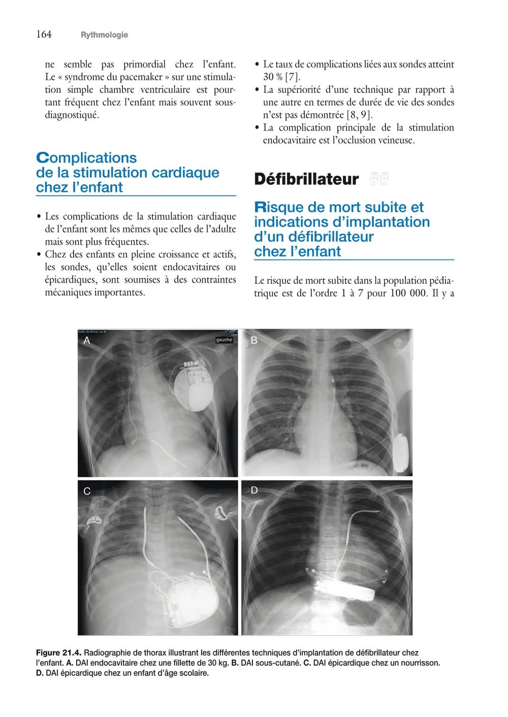 Chapitre 21. Stimulation cardiaque définitive et défibrillation, page 164