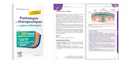 Pathologies et thérapeutiques en soins infirmiers - l'essentiel en 215 fiches