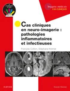 Neuro-imagerie - pathologies inflammatoires et infectieuses