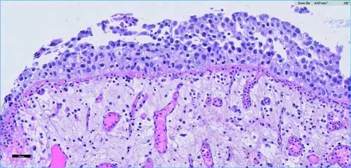 pathologie-g-n-rale-pour-les-tudiants-en-dfgsm