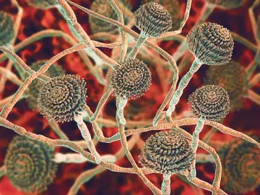 烟曲霉子实体（分生孢子）和菌丝的计算机图解。（图片由Kateryna Kon/科学图片库通过Getty Images提供）